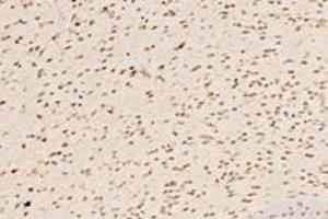 Immunohistochemistry analysis of paraffin-embedded mouse striatum using,IRX1 (ABIN7074377) at dilution of 1: 4400 (IRX1 antibody)