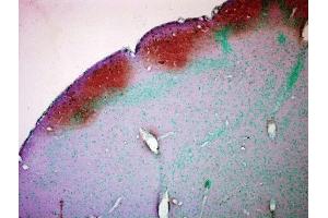 Immunohistochemistry analysis using Mouse Anti-CaMKII Monoclonal Antibody, Clone 22B1 . (CAMKII gamma antibody  (Atto 390))