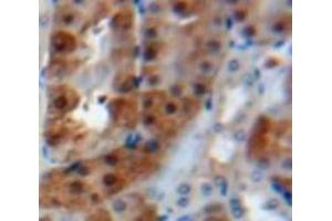 Used in DAB staining on fromalin fixed paraffin-embedded Kidney tissue (Calreticulin antibody  (AA 18-193))