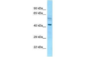 WB Suggested Anti-Nap1l4 Antibody Titration: 1. (NAP1L4 antibody  (N-Term))
