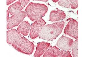 Human Skeletal Muscle: Formalin-Fixed, Paraffin-Embedded (FFPE) (SEMA4D/CD100 antibody  (AA 812-862))