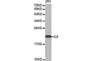 Western blot analysis of extracts of 293 cell line, using IL6 antibody. (IL-6 antibody)