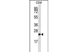 Western blot analysis of anti-FGF4 Antibody (C-term) (ABIN392776 and ABIN2842218) in CEM cell line lysates (35 μg/lane).