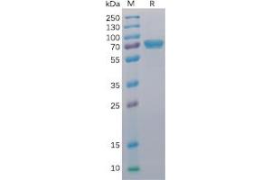 Human CD40 Protein, mFc-His Tag on SDS-PAGE under reducing condition. (CD40 Protein (CD40) (mFc-His Tag))