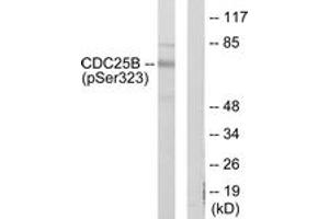 Western blot analysis of extracts from NIH-3T3 cells treated with PMA 125ng/ml 30', using CDC25B (Phospho-Ser323) Antibody. (CDC25B antibody  (pSer323))