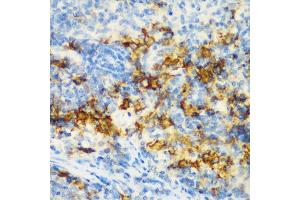 Immunohistochemistry of paraffin-embedded rat spleen using CD3D antibody (ABIN5970580) at dilution of 1/200 (40x lens). (CD3D antibody)