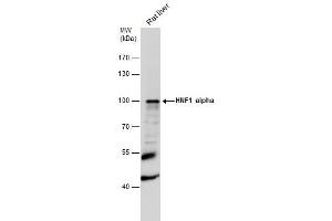 WB Image HNF1 alpha antibody [N1N3] detects HNF1 alpha protein by western blot analysis. (HNF1A antibody)