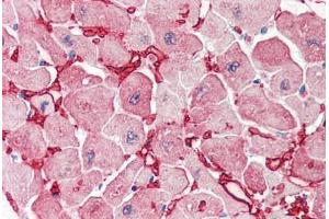 Human Heart (formalin-fixed, paraffin-embedded) stained with GOT1 antibody ABIN337132 at 2. (GOT1 antibody  (AA 157-167))