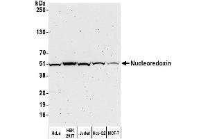 anti-Nucleoredoxin (NXN) (AA 385-435) antibody