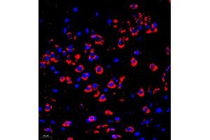 Immunofluorescence of paraffin embedded mouse brain using P4H (ABIN7074215) at dilution of 1:700 (400x lens) (HIF Prolyl Hydroxylase antibody)
