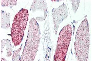 Human Skeletal Muscle (formalin-fixed, paraffin-embedded) stained with ACO2 antibody ABIN462115 followed by biotinylated goat anti-rabbit IgG secondary antibody ABIN481713, alkaline phosphatase-streptavidin and chromogen. (ACO2 antibody  (AA 438-467))