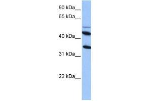 IL13RA2 antibody used at 1 ug/ml to detect target protein.