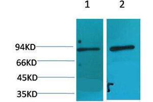 Western Blotting (WB) image for anti-Aryl Hydrocarbon Receptor Nuclear Translocator (ARNT) antibody (ABIN3181510) (ARNT antibody)