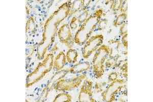 Immunohistochemistry of paraffin-embedded rat kidney using HSPA9 antibody. (HSPA9 antibody  (AA 380-679))
