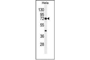 Western Blotting (WB) image for anti-Prostaglandin-Endoperoxide Synthase 2 (Prostaglandin G/H Synthase and Cyclooxygenase) (PTGS2) (AA 370-399), (Middle Region) antibody (ABIN951767)