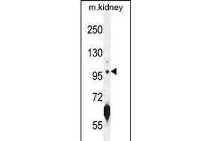 ATPGD1 Antibody (N-term) (ABIN654537 and ABIN2844255) western blot analysis in mouse kidney tissue lysates (35 μg/lane).