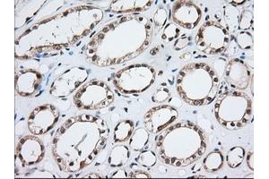 Immunohistochemical staining of paraffin-embedded Human prostate tissue using anti-MOBKL1A mouse monoclonal antibody. (MOBKL1A antibody)