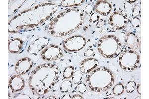 Immunohistochemical staining of paraffin-embedded Human prostate tissue using anti-MOBKL1A mouse monoclonal antibody.