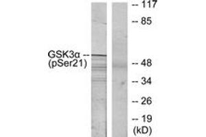 Western blot analysis of extracts from ovary cancer, using GSK3 alpha (Phospho-Ser21) Antibody. (GSK3 alpha antibody  (AA 10-59))
