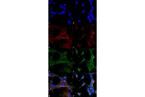 Immunocytochemistry/Immunofluorescence analysis using Mouse Anti-4-Hydroxy-2-hexenal Monoclonal Antibody, Clone 6F10 . (4-Hydroxy-2-Hexenal (4-HHE) antibody (Biotin))