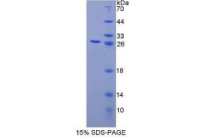 SDS-PAGE analysis of Human CHP Protein. (CHP Protein)