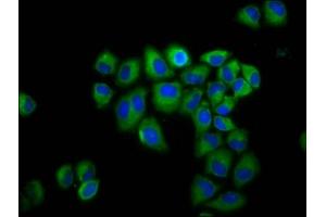 Immunofluorescence staining of Hela cells with ABIN7154190 at 1:200, counter-stained with DAPI. (GLRB antibody  (AA 355-472))