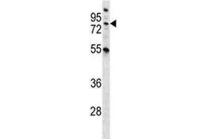 MST1 antibody western blot analysis in NCI-H460 lysate. (MST1 antibody  (AA 454-483))