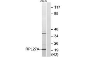 Western blot analysis of extracts from COLO cells, using RPL27A Antibody. (RPL27A antibody  (AA 99-148))