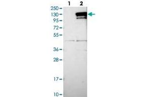 Western blot analysis of Lane 1: Negative control (vector only transfected HEK293T lysate), Lane 2: Over-expression Lysate (Co-expressed with a C-terminal myc-DDK tag (~3. (CCDC146 antibody)