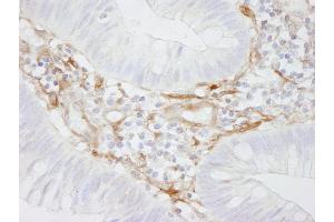 anti-Filamin A, alpha (FLNA) (AA 1725-1775) antibody