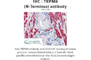 Image no. 2 for anti-Transient Receptor Potential Cation Channel, Subfamily M, Member 8 (TRPM8) (Cytoplasmic Domain), (N-Term) antibody (ABIN1740398) (TRPM8 antibody  (Cytoplasmic Domain, N-Term))