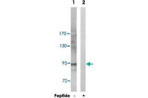Western blot analysis of extracts from Jurkat cells, using ZAK polyclonal antibody . (ZAK antibody  (Ser165))