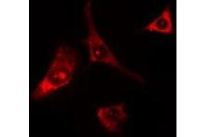 ABIN6275680 staining Hela cells by IF/ICC. (WIPF1 antibody  (C-Term))