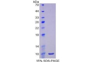 SDS-PAGE of Protein Standard from the Kit  (Highly purified E. (IL-6 Receptor ELISA Kit)