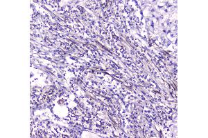 IHC analysis of CES1 using anti-CES1 antibody . (CES1 antibody  (AA 99-206))