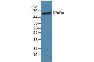 Western blot analysis of Rat Lung Tissue. (Angiopoietin 1 antibody  (AA 304-450))