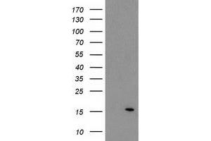 HEK293T cells were transfected with the pCMV6-ENTRY control (Left lane) or pCMV6-ENTRY ATP6V1F (Right lane) cDNA for 48 hrs and lysed. (ATP6V1F antibody)