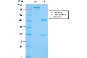 SDS-PAGE Analysis Purified GRP94 Recombinant Rabbit Monoclonal (HSP90B1/3168R). (Recombinant GRP94 antibody)