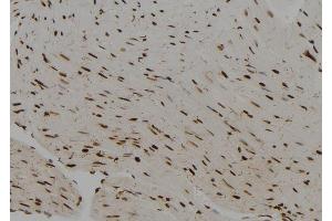 ABIN6279641 at 1/100 staining Rat heart tissue by IHC-P. (PRRX2 antibody  (Internal Region))