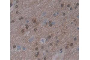 Used in DAB staining on fromalin fixed paraffin- embedded Kidney tissue (KHDRBS1 antibody  (AA 152-381))