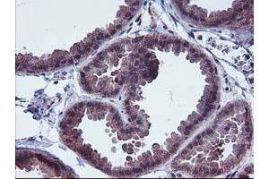 Immunohistochemical staining of paraffin-embedded Human breast tissue using anti-FGFR2 mouse monoclonal antibody. (FGFR2 antibody)