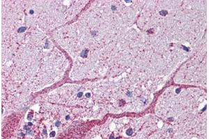 Human Brain, Cerebellum (GCLC antibody  (AA 74-123))