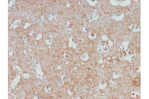 Formalin-fixed, paraffin-embedded human Cerebellum stained with Neurofilament Rabbit Monoclonal Antibody (NEFL/2983R).