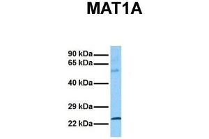 Host:  Rabbit  Target Name:  MAT1A  Sample Tissue:  Human Ovary Tumor  Antibody Dilution:  1. (MAT1A antibody  (C-Term))