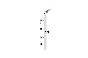 Anti-M1 Antibody (Center) at 1:2000 dilution + Human brain lysate Lysates/proteins at 20 μg per lane. (AP1M1 antibody  (AA 199-227))