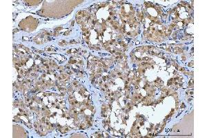 IHC analysis of Glutathione Reductase using anti-Glutathione Reductase antibody (ABIN5693151). (Glutathione Reductase antibody  (AA 256-522))