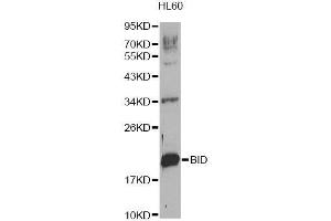 Western blot analysis of extracts of HL-60 cells, using BID Antibody. (BID antibody  (AA 1-130))