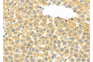 ABIN6260778 and ABIN6277329 at 1/100 staining Rat liver tissue by IHC-P.