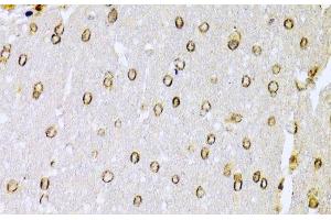 Immunohistochemistry of paraffin-embedded Rat brain using KU70 Polyclonal Antibody at dilution of 1:100 (40x lens). (XRCC6 antibody)