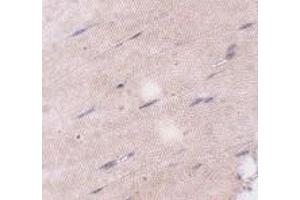 Immunohistochemistry of FNIP2 in mouse skeletal muscle tissue with FNIP2 antibody at 5 μg/ml.